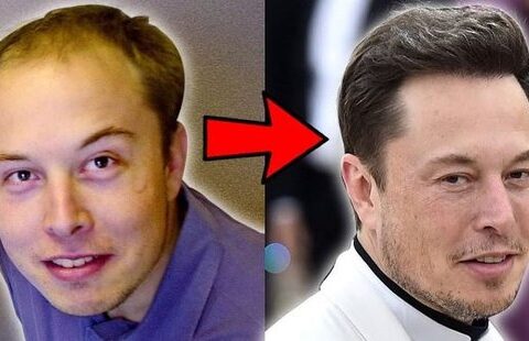 Elon Musk Bald
